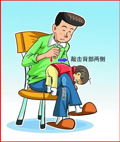 孩子异物卡喉的急救方法